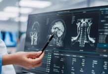 Hope Emerges Against Deadly Brain Cancer Healthcare professional analyzing MRI scans on a computer screen