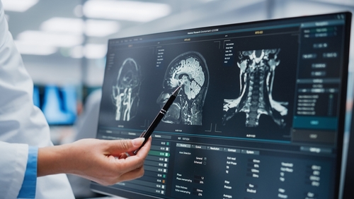 Medical,Hospital:,Neurologist,And,Neurosurgeon,Talk,,Use,Computer,,Analyse,Patient Healthcare professional analyzing MRI scans on a computer screen